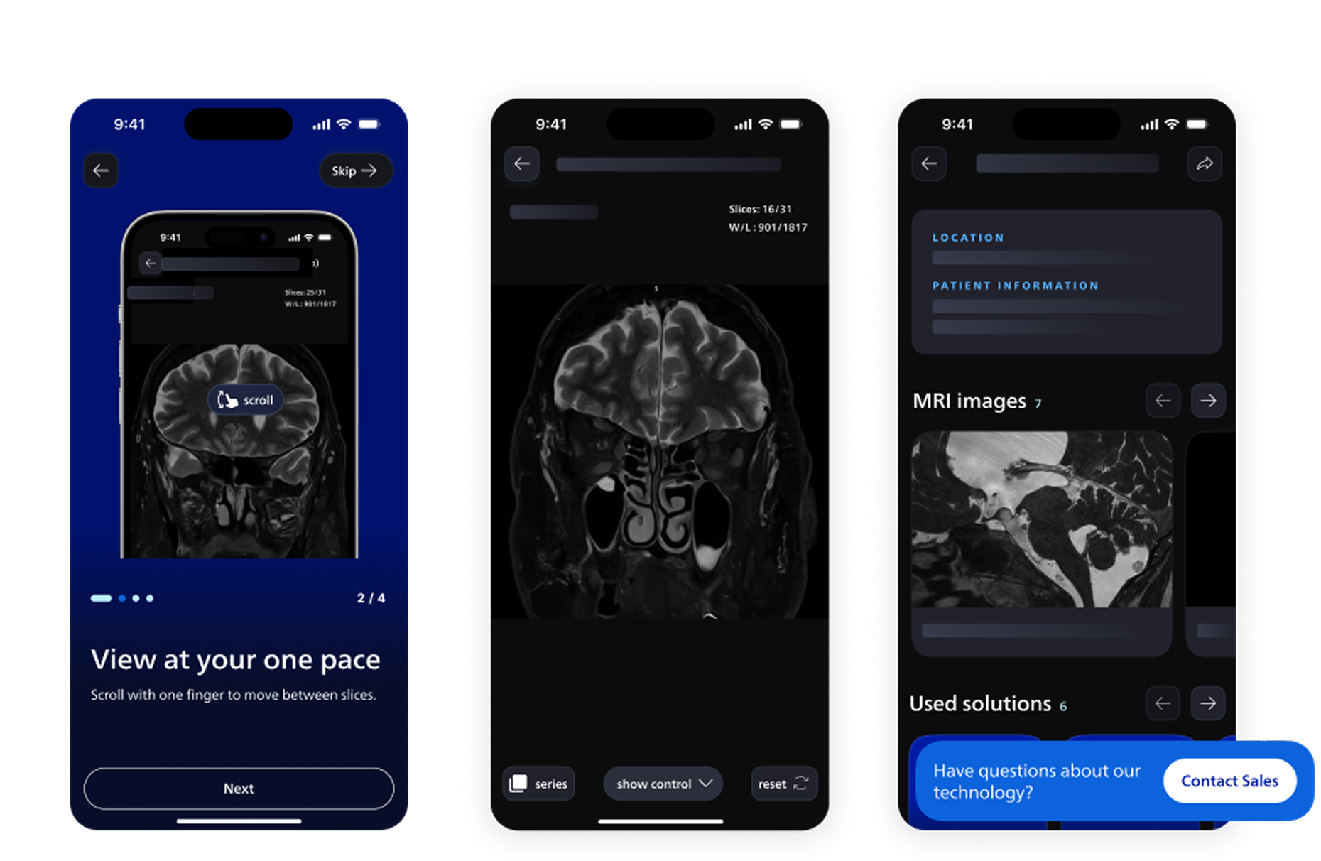 Three mobile screens from a medical imaging app showing MRI brain scan viewing, scrolling controls, and patient case details.