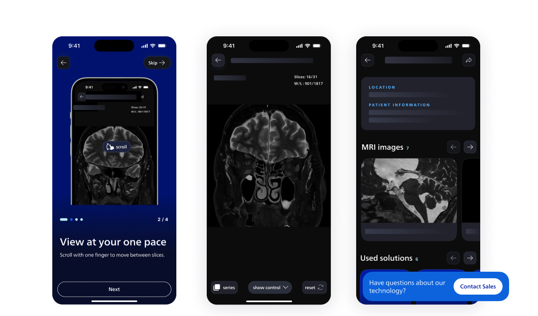 Composition of 3 screenshots of a medical tech app